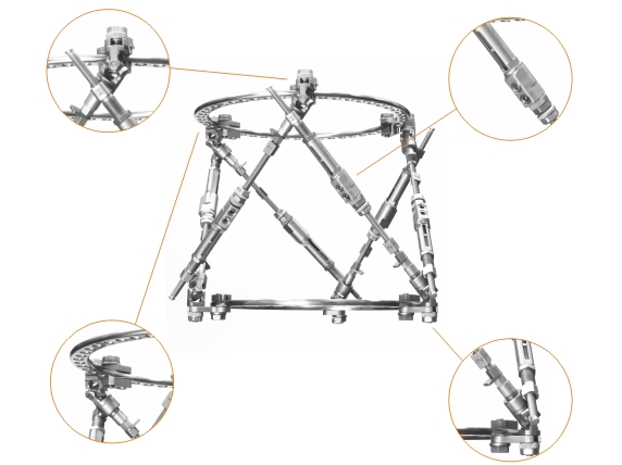 Ring Fixation System 